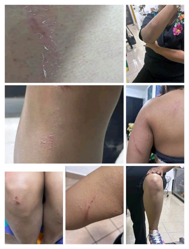 V&iacute;ctimas de robo con violencia e intento de violaci&oacute;n exigen medidas cautelares