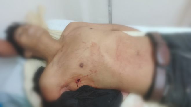 Asesinan a habitante de Aldama