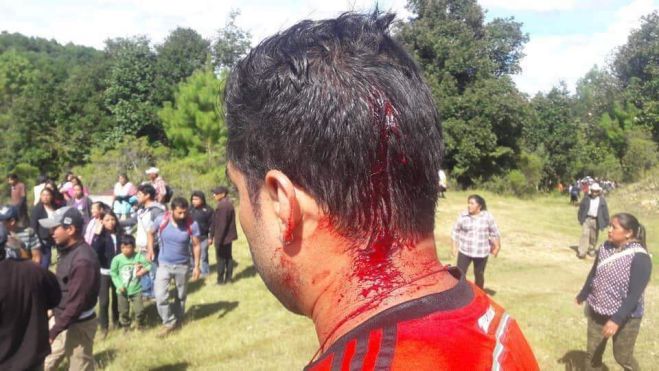 Ambientalistas son agredidos con palos y piedras